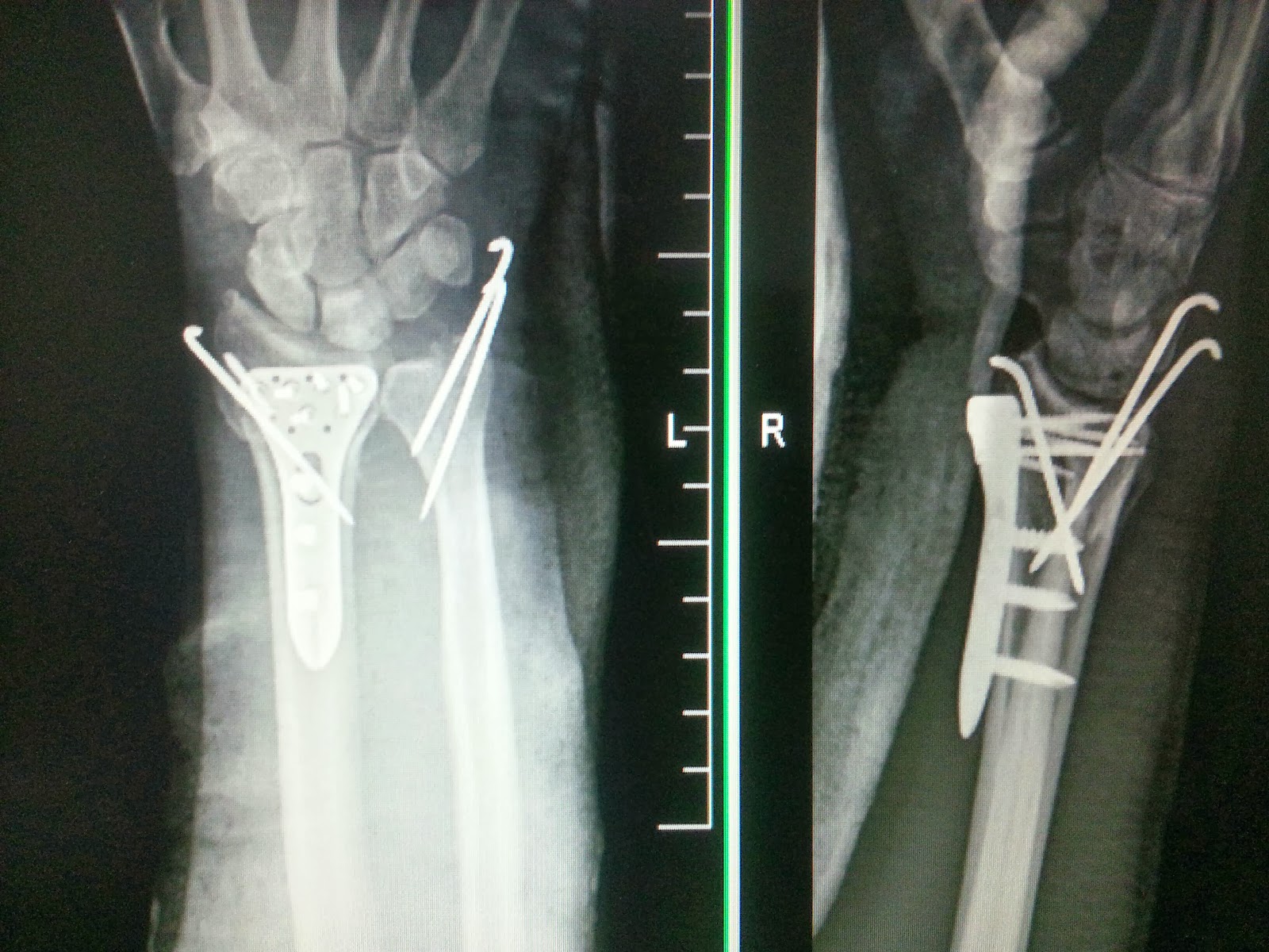 鍾承翰醫師骨科chen Han Chung M D Orthopaedic Surgeon 一月14