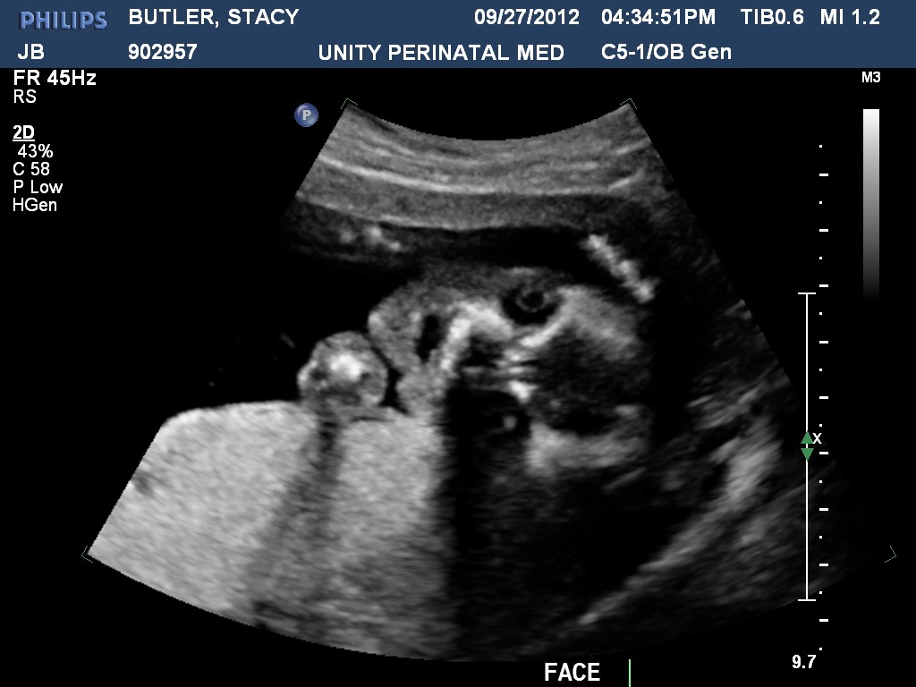 [BUTLERSTACY201209271634519832.jpg]