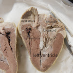 bicuspid_valve_labeled.JPG