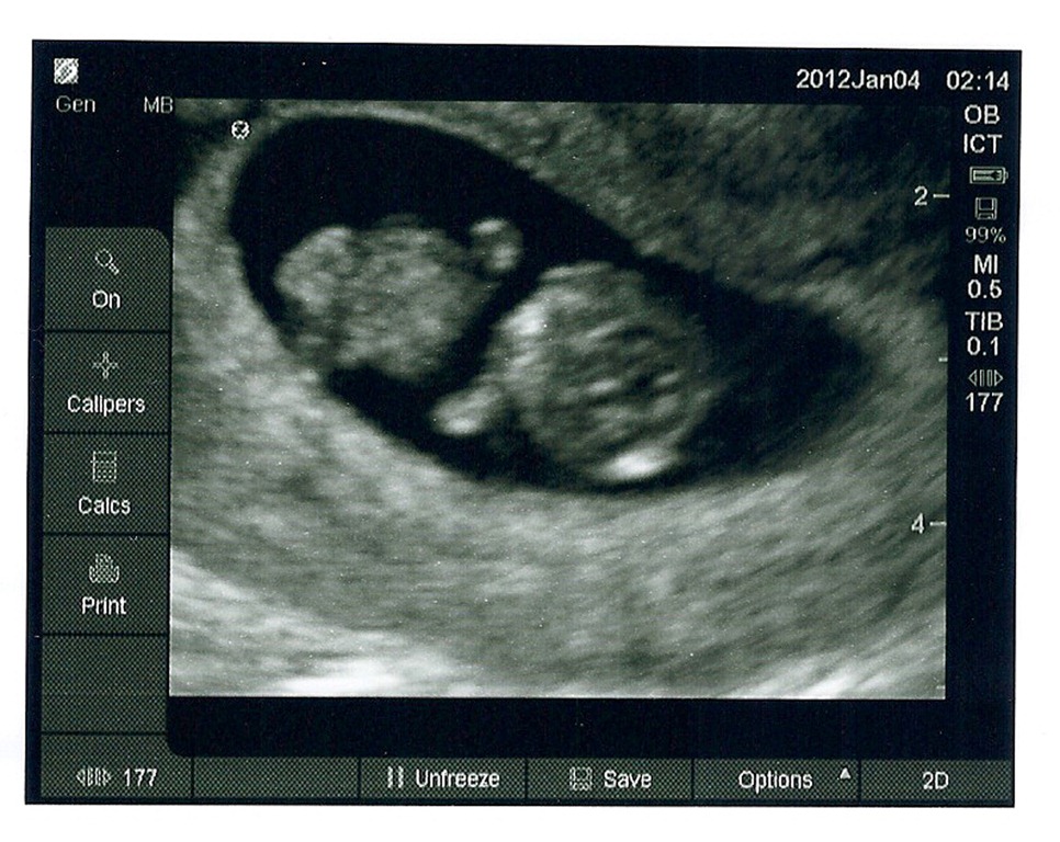 [baby%255B4%255D.jpg]