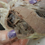 z_myocardium.JPG