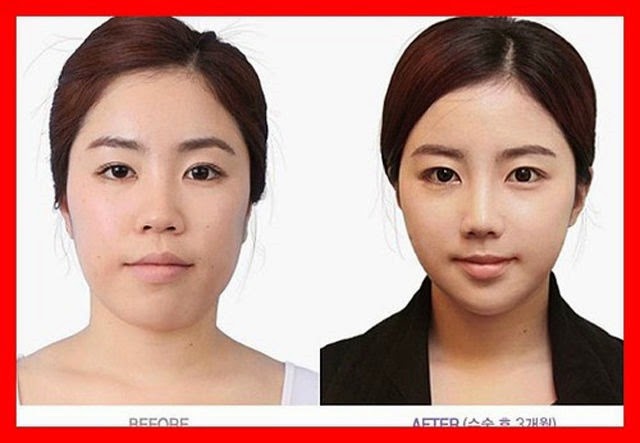 [korean-plastic-surgery-8%255B2%255D.jpg]