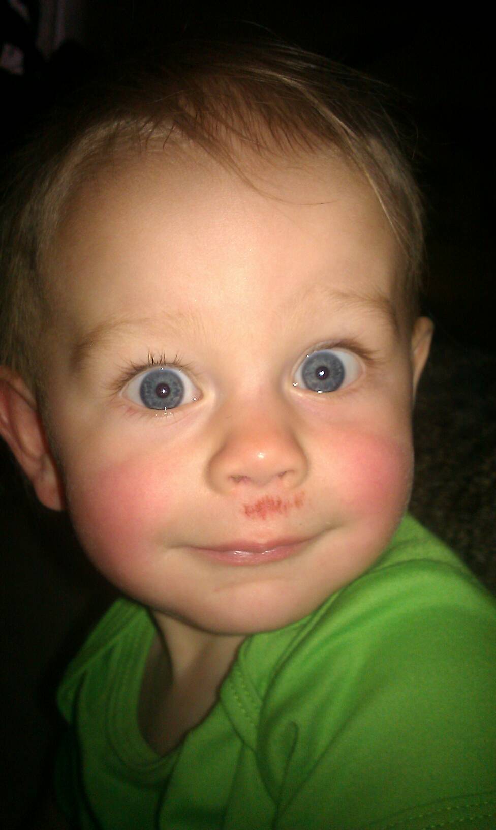 Fat Lip
