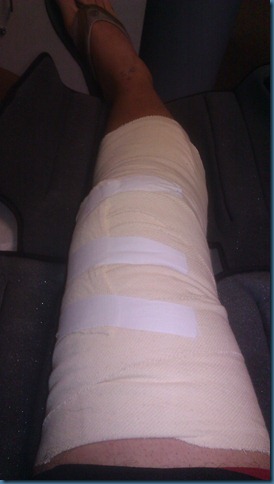 acl_post_op_bandage