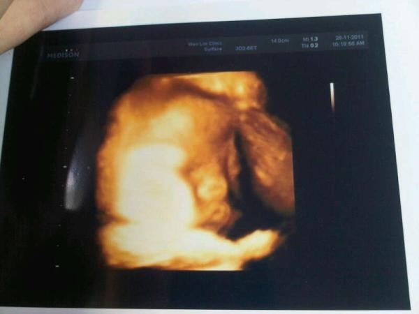 [baby%25203D%2520scan2%255B3%255D.jpg]