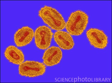Variola Major, Smallpox Virus