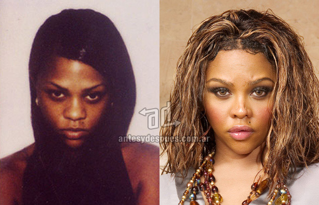 La nueva nariz operada de Lil Kim