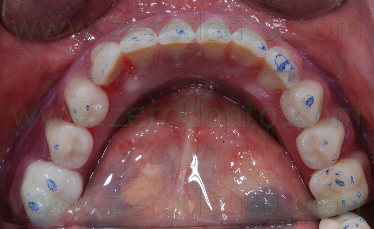 [prova-denti2.jpg]