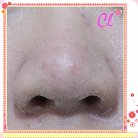 nose_副本 copy