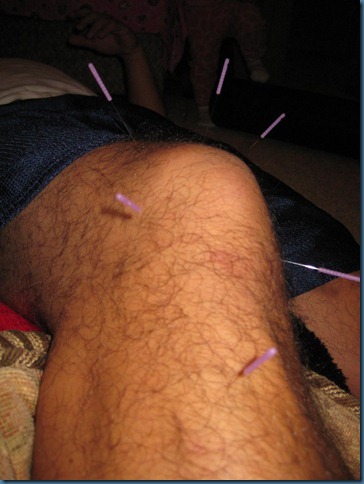 knee