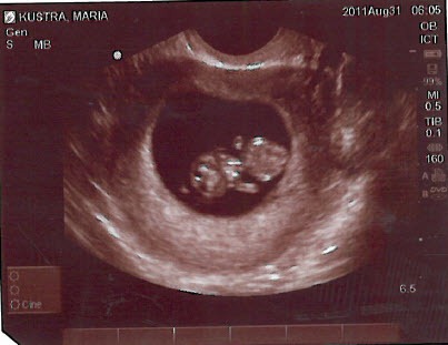 [8-31-2011%25201-08-29%2520PM%255B3%255D.jpg]