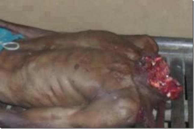 the beheaded body of Sudhakar Singh the beheaded body of Sudhakar Singh