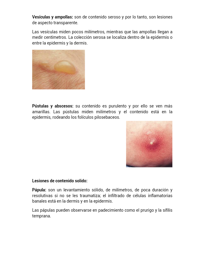 LESIONES ELEMENTALES EN LA PIEL lesiones elementales en la piel: