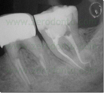 FIG N 36