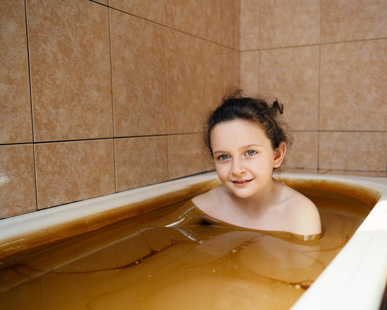 naftalan-crude-oil-baths-3