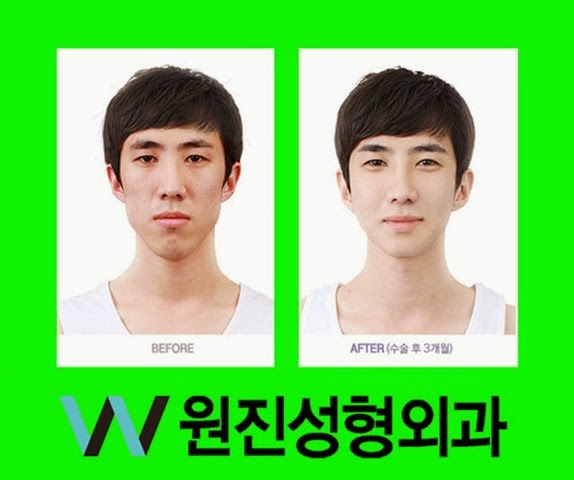 [korean-plastic-surgery-41%255B2%255D.jpg]