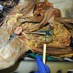 ureter.JPG