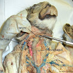 larynx_L.JPG