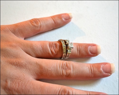 swollen fingers swollen fingers