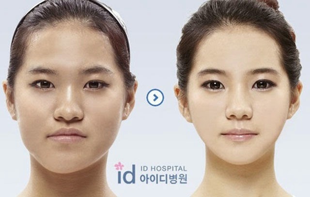 [korean-plastic-surgery-4%255B2%255D.jpg]