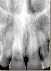Preop radiograph1017