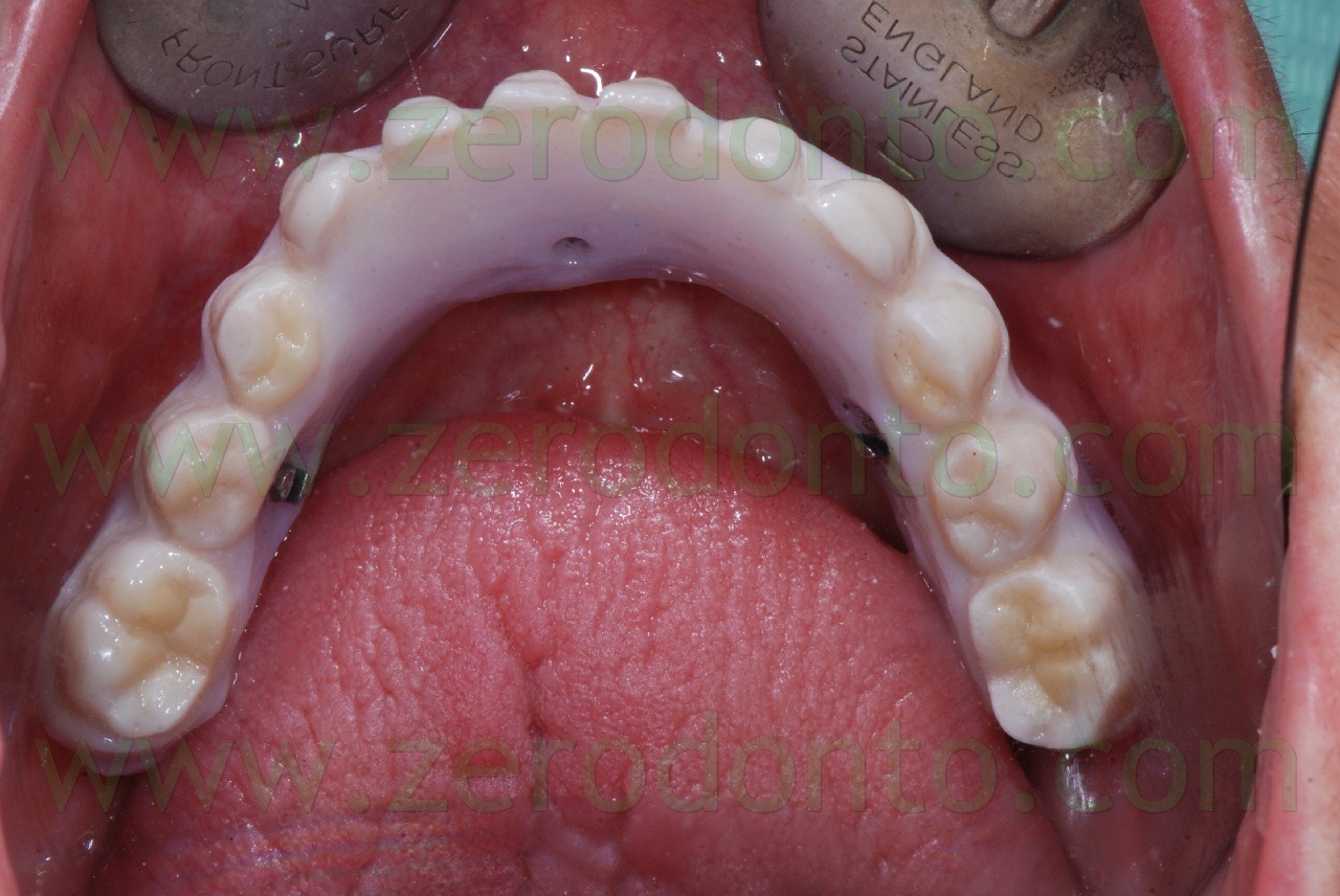 [zirconia2.jpg]