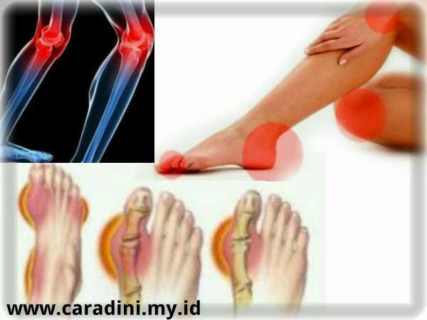 Asam urat Asam urat