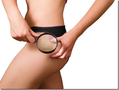como reducir la celulitis como reducir la celulitis
