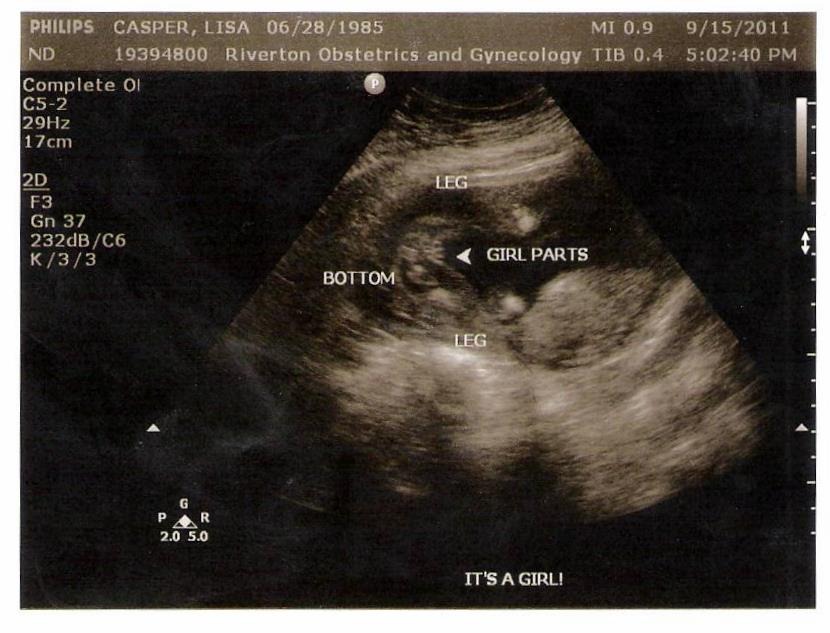 [baby%2520%25233%2520girl%255B2%255D.jpg]
