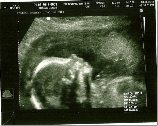 scan0004