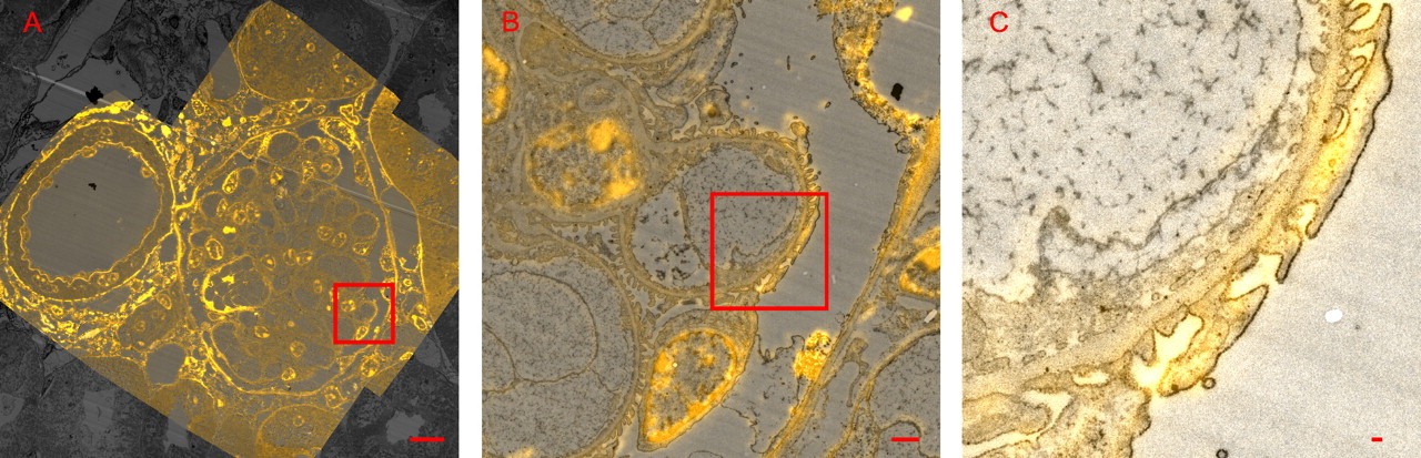 [virtual_nanoscopy%255B5%255D.jpg]