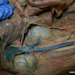 kidneys.JPG