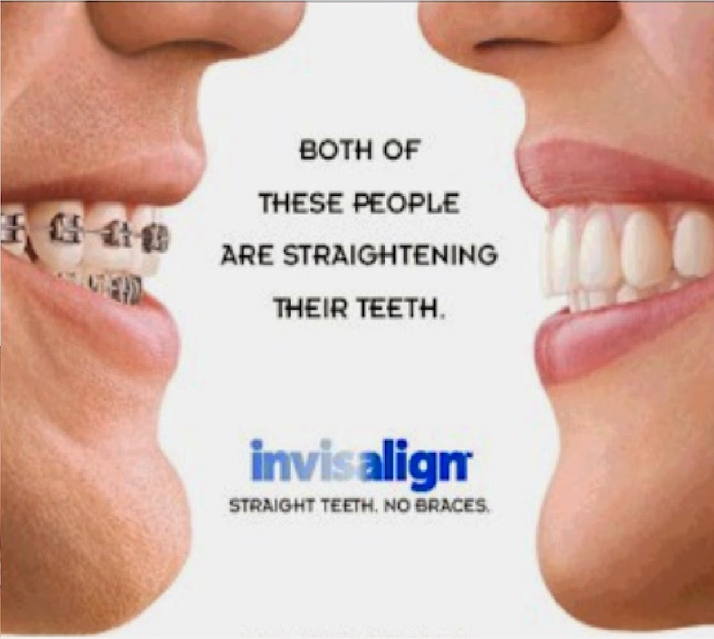 Invisalign Las Vegas Wagner Dental