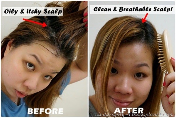 diy itchy scalp diy itchy scalp