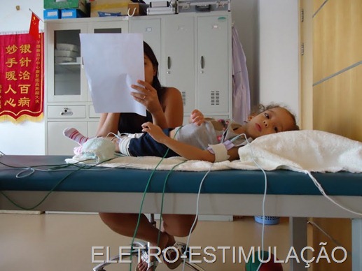 [ELETRO-ESTIMULA%25C3%2587%25C3%2583O%2520%25282%2529%255B15%255D.jpg]