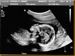 baby boy scan 2