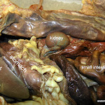 kidney_L.JPG