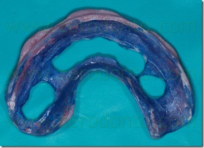 portaimpronte individuale