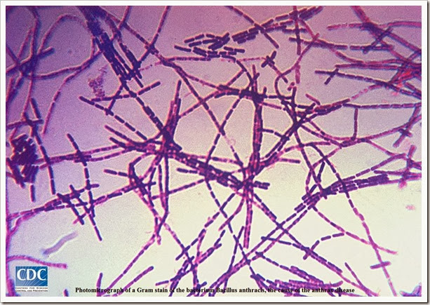 Photomicrograph of a Gram stain of the bacterium Bacillus anthracis, the cause of the anthrax disease