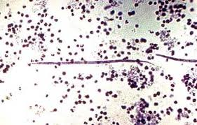 microfilariae in the blood