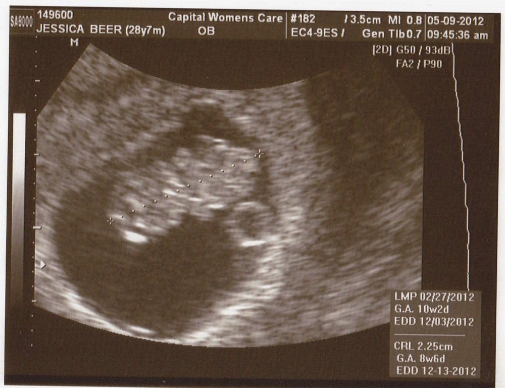 [Sonogram%25205-9-12%2520A%255B3%255D.jpg]