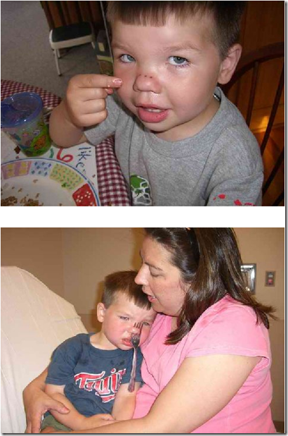 Eso tiene que doler - Niño tenedor Eso tiene que doler - Niño tenedor