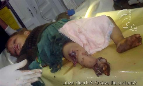 [baby-injured-by-nato-LIBYA-OIL-WAR%255B22%255D.jpg]