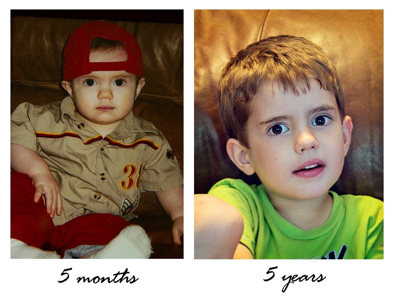 [beforeandafterSIDEBYSIDE%255B5%255D.jpg]