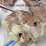 heart_valve_labeled.JPG