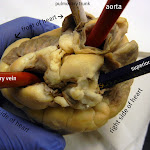 heart_top_surface_labeled.JPG