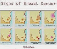 breast cancer signs