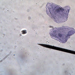cell_cheek_04_400x.jpg