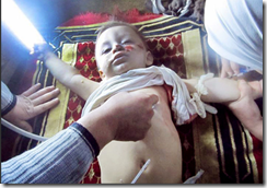 Wounded child in Homs
