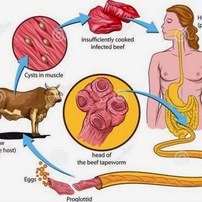 Beef tapeworm, Lifecycle, Clinical Signs, Diagnosis and Treatment